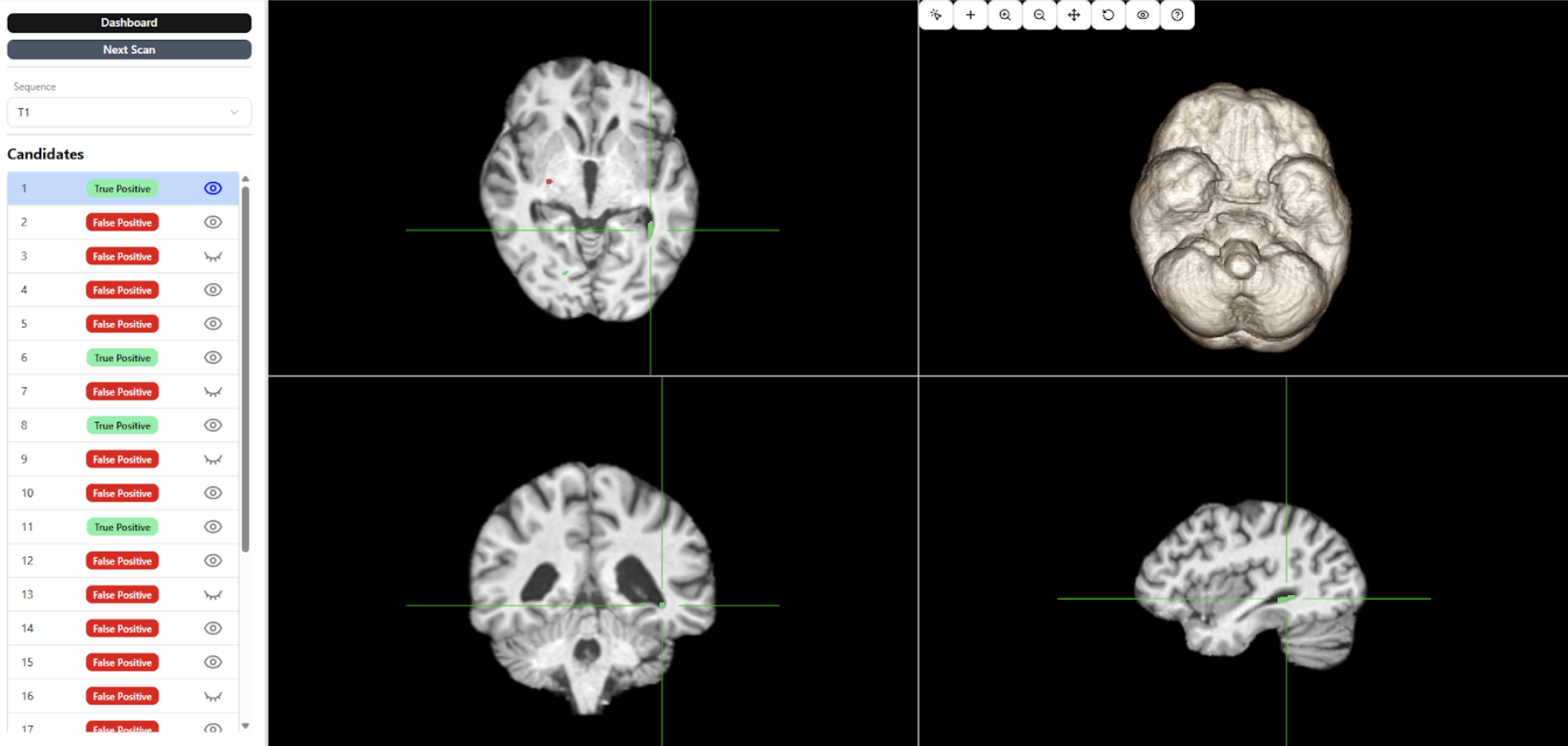 MRI Viewer and Annotation Management System